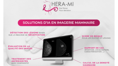 découvrez le lancement du programme lg6, une initiative innovante en ia appliquée à la medtech. explorez comment cette technologie transforme le secteur de la santé en offrant des solutions avancées pour les professionnels et améliorant le soin des patients.